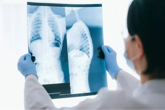 Spinal Cord Accident
